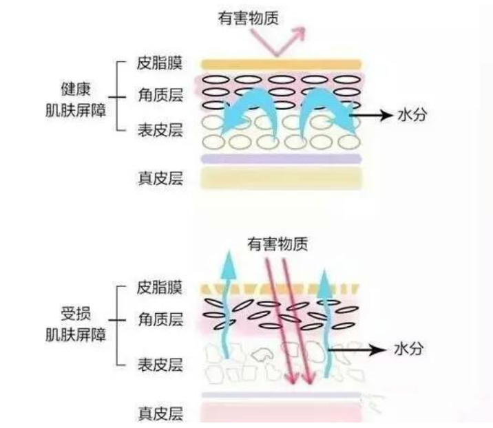 干、癢、紅、腫？別慌涂護(hù)膚品，先看看皮膚屏